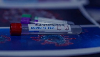 Coronavirus testing tube samples