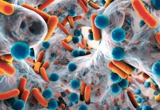 superbugs resistant to drugs expected to kill 39 million by 2025